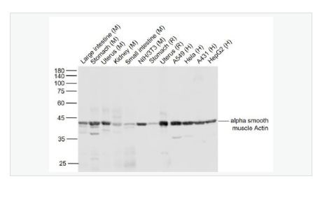Anti-alpha-肌动蛋白α/α-SMA/α Actin单克隆抗体