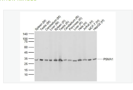 Anti-PSMA1 antibody-蛋白酶体PSMα1重组兔单克隆抗体