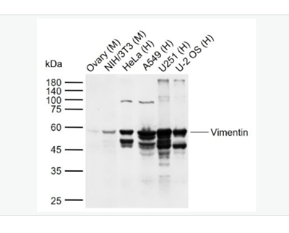 Anti-Vimentin antibody - 波形蛋白抗体