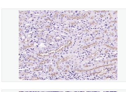 Anti-ACE2  antibody- 血管紧张素转换酶2抗体