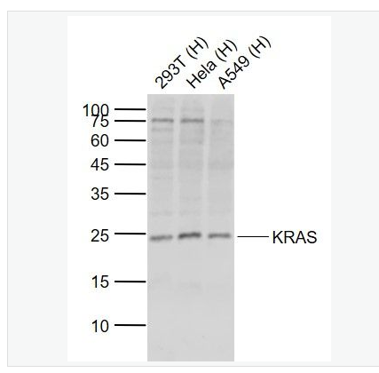 Anti-KRAS antibody- 原癌基因K-ras抗体