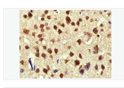 Anti-Cyclin D1 antibody-周期素D1抗体