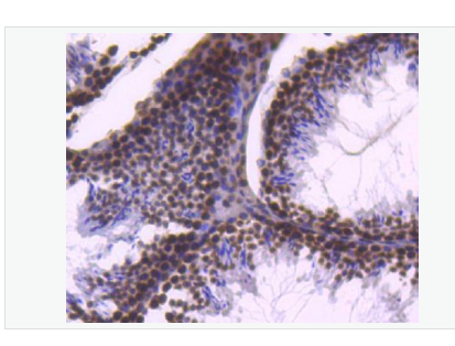 Anti-Histone H2B antibody-组蛋白H2B重组兔单克隆抗体