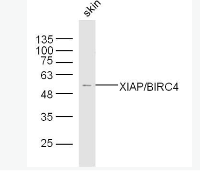 Anti-XIAP/BIRC4 antibody-X-连锁凋亡蛋白/性连锁凋亡抑制蛋白抗体