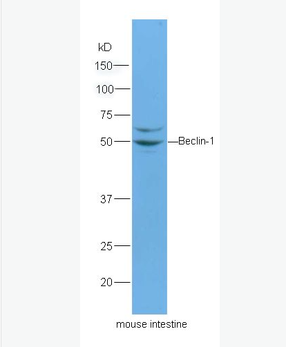 Anti-Beclin 1 antibody-自噬效应蛋白Beclin 1抗体