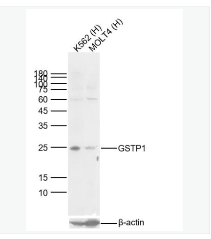 Anti-GSTP1  antibody  -谷胱甘肽硫转移酶pi重组兔单克隆抗体