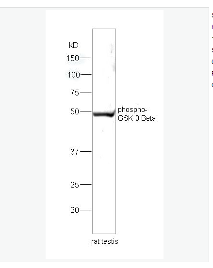 Anti-phospho-GSK-3 Beta antibody  -磷酸化糖原合酶激酶-3β抗体