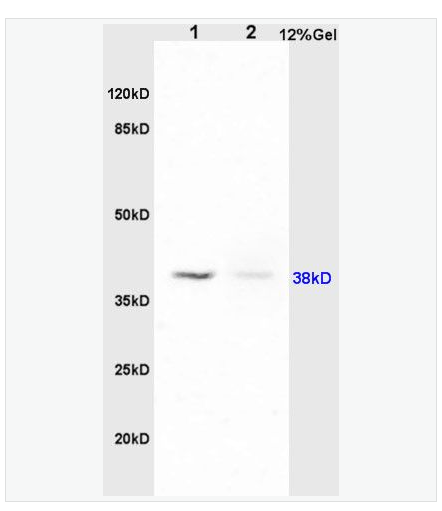 Anti-PAFR/PAF Receptor antibody  -血小板活化因子受体抗体