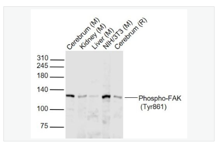 Anti-Phospho-FAK antibody  -磷酸化粘着斑激酶抗体