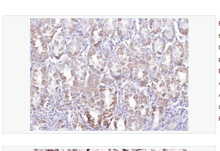 Anti-LIM kinase 1 + 2  antibody-单丝氨酸蛋白激酶1+2抗体