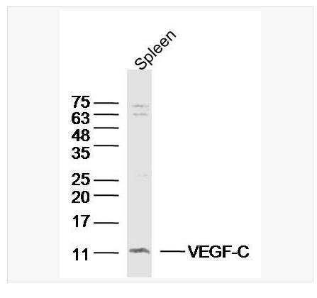 Anti-VEGF-C antibody-血管内皮生长因子C型抗体