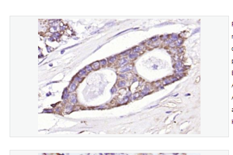 Anti-EpCAM antibody-上皮特异性抗原（CD326）抗体