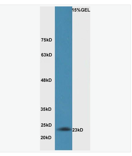 Anti-Bak antibody-Bcl-2同源拮抗剂抗体