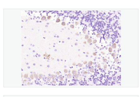 Anti-phospho-GAP43 antibody-磷酸化神经生长相关蛋白43抗体