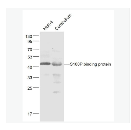 Anti-FCAR/CD89  antibody-免疫球蛋白A Fc段受体1抗体