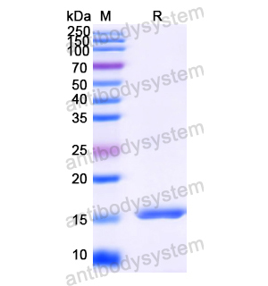 Anti-HIV-1 nef/F-protein protein Antibody (SAA1423)