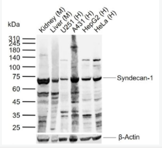 Syndecan-1 多配体蛋白聚糖1（CD138）抗体