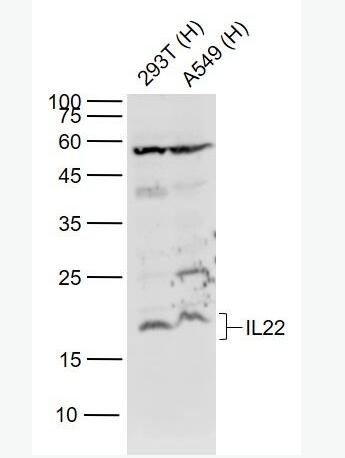 IL-22 白介素-22抗体