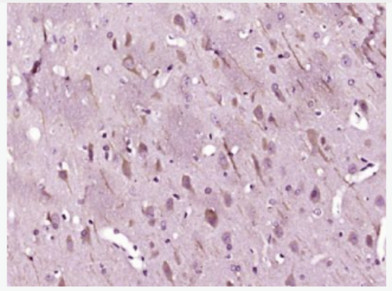 Anti-LC3B antibody -自噬微管相关蛋白轻链3抗体