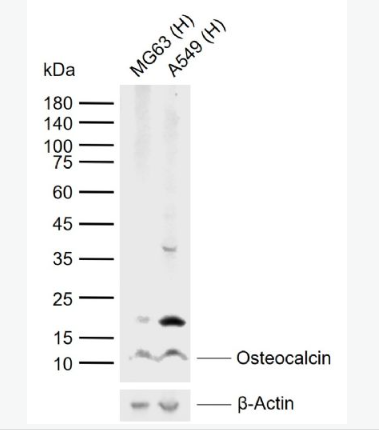 Anti-Osteocalcin antibody -骨钙蛋白/骨钙素抗体