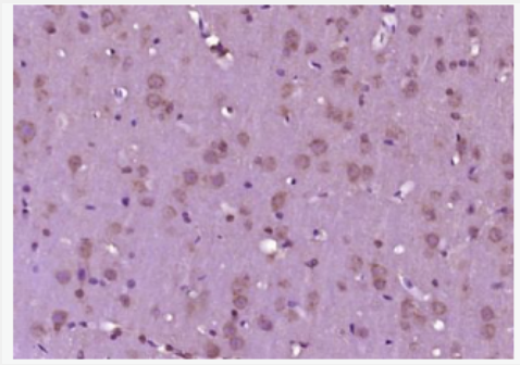 Anti-CGRP-1/2 antibody -降钙素基因相关肽1/2抗体