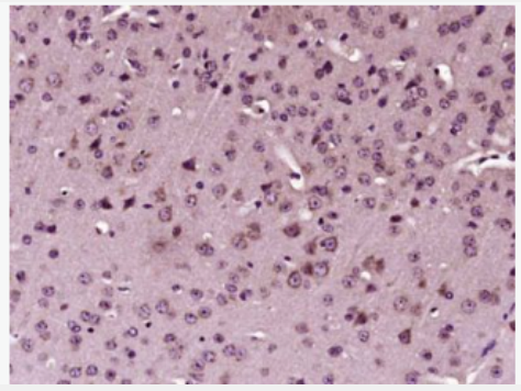 Anti-phospho-STAT1 (Tyr701) antibody-磷酸化信号转导与转录激活因子1抗体