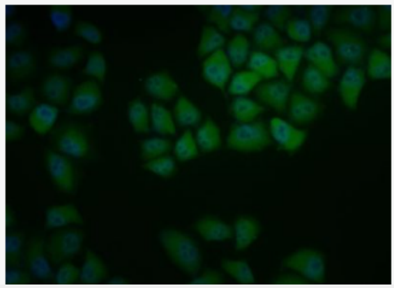 Anti-ID1  antibody-DNA结合抑制因子1抗体