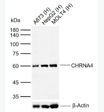 Anti-CHRNA4 antibody-烟碱型乙酰胆碱受体α4抗体