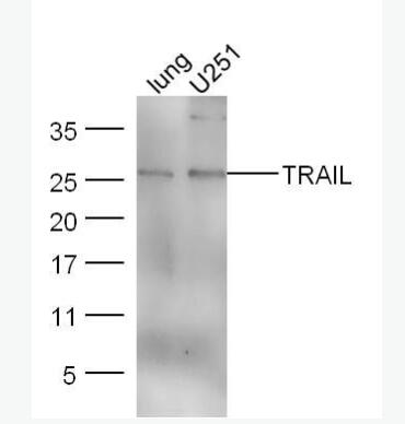 Anti-TRAIL antibody-肿瘤坏死因子相关凋亡诱导配体抗体