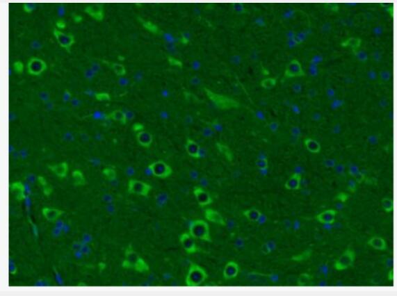 Anti-Somatostatin 14/Somatostatin 28 antibody-生长抑素抗体