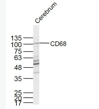 Anti-CD68 antibody-CD68抗体