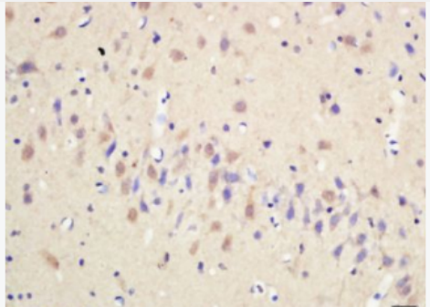 Anti-5-HT antibody-5羟色胺抗体