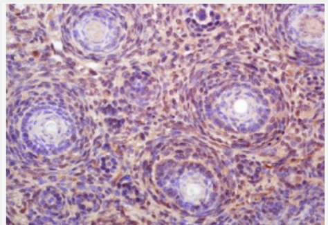 Anti-NUF2 antibody-细胞分裂周期相关蛋白1抗体