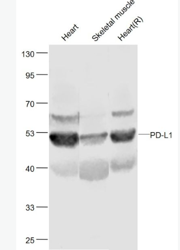 Anti-PD-L1 antibody-程序性死亡配体1（CD274）抗体