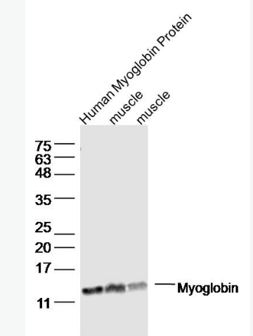 Anti-Myoglobin  antibody-肌红蛋白抗体