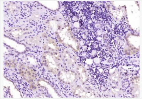 Anti-FMN1 antibody-肢体畸形相关蛋白FMN1抗体