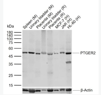 Anti-PTGER2 antibody-前列腺素E2受体2抗体