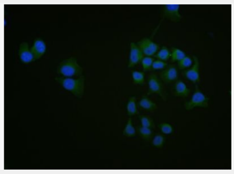 Anti-phospho-RAC1 + RAC2 (Ser71) antibody-磷酸化细胞迁移诱导因子5抗体