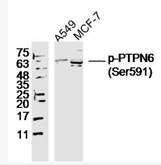 Anti-phospho-PTPN6 (Ser591) antibody-磷酸化蛋白酪氨酸磷酸酶1C抗体