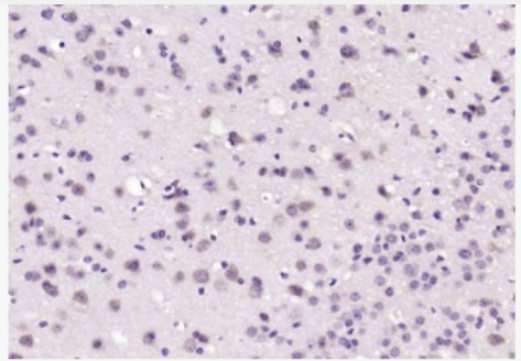 Anti-PAFAHG antibody-血小板衍化生长因子γ抗体