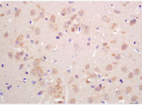 Anti-VGLUT2 antibody-囊泡谷氨酸转运蛋白2抗体