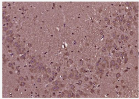 Anti-beta-Amyloid 1-42 (CT) antibody-β淀粉样肽1-42(C端)/β-Amyloid 1-42 (CT)抗体