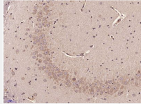 Anti-SOCS2 antibody-细胞因子信号传导抑制蛋白2抗体