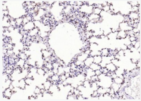 Anti-Melan A antibody-黑色素瘤相关抗原/黑色素-A抗体