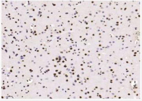 Anti-beta-Amyloid(25-35) antibody-β淀粉样肽（25-35）抗体