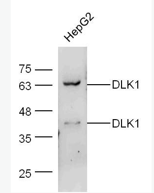 Anti-DLK1 antibody-穿膜蛋白DLK1抗体