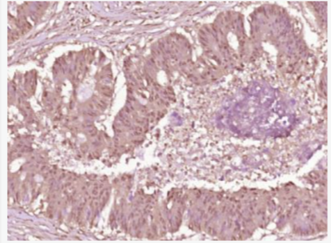 Anti-Phospho-cdc25A (Ser178) antibody-磷酸化细胞分裂周期蛋白25抗体