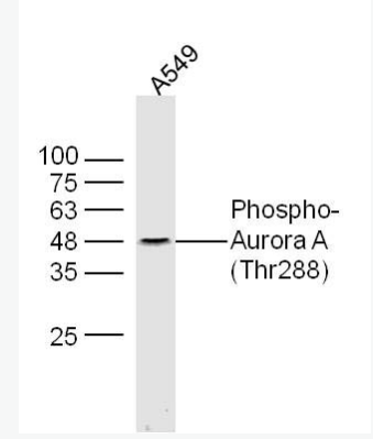 Anti-Phospho-Aurora A (Thr288) antibody-磷酸化有丝分裂激酶A抗体