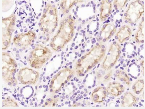 Anti-Cystatin C antibody-胱抑素C/半胱氨酸蛋白酶抑制剂C抗体