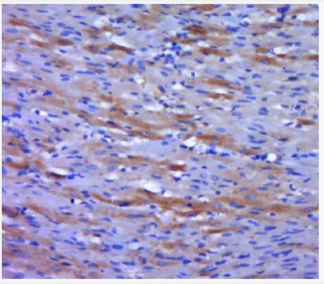 Anti-phospho-VEGFR2 (Tyr951) antibody-磷酸化血管内皮生长因子受体2抗体